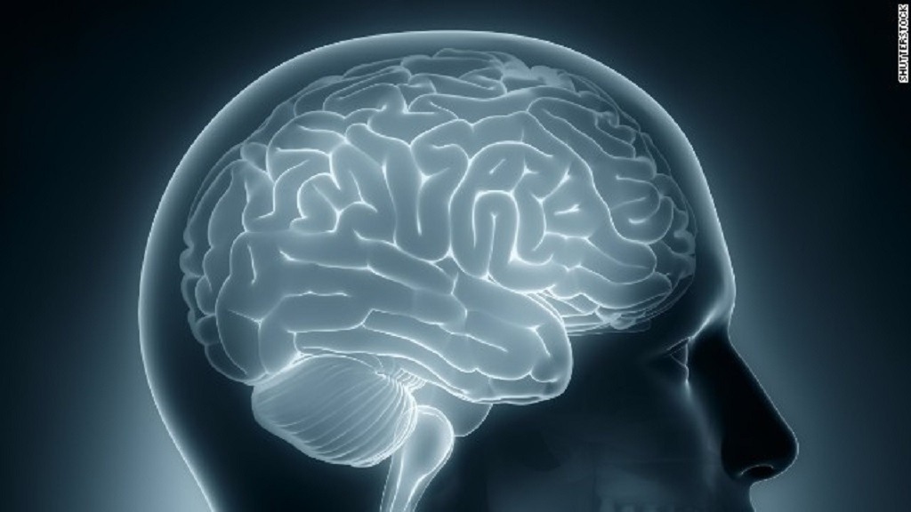 Мозг и память после 40. Brain Dementia группа. Болезнь Альцгеймера деменция. Фон для презентации болезнь Альцгеймера.