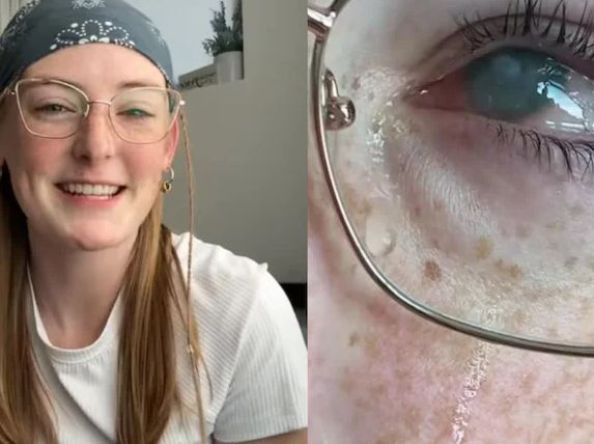 မျက်ကပ်မှန်တပ်ပြီး ရေချိုးမိလိုက်လို့ မျက်စိကွယ်သွားခဲ့ရတဲ့ အသက် ၂၀ အရွယ်မိန်းကလေး