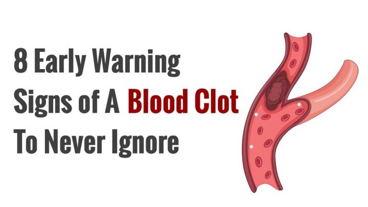 blood-clot-warning-signs.jpg