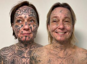 ချစ်သူဟောင်းရဲ့ အတင်းအကြပ်ခိုင်းစေမှုကြောင့် ရေးထိုးခဲ့ရတဲ့ တက်တူး ၂၅၀ ကို ဖယ်ရှားဖို့ ကြိုးစားနေသူ