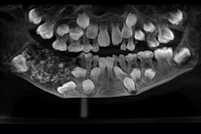 teeth52601.jpg
