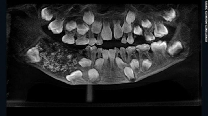 teeth52601.jpg